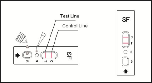 Procedure of NewScen Serum Ferritin (SF) quantitative rapid test Cassette